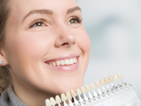 Bleaching &ndash; Mehr als nur wei&szlig;e Z&auml;hne